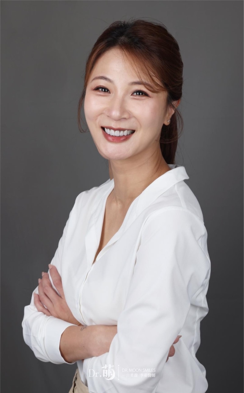 陶瓷貼片術後笑容，牙齒中線協調、比例自然